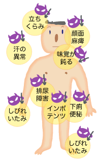 神経障害イラスト